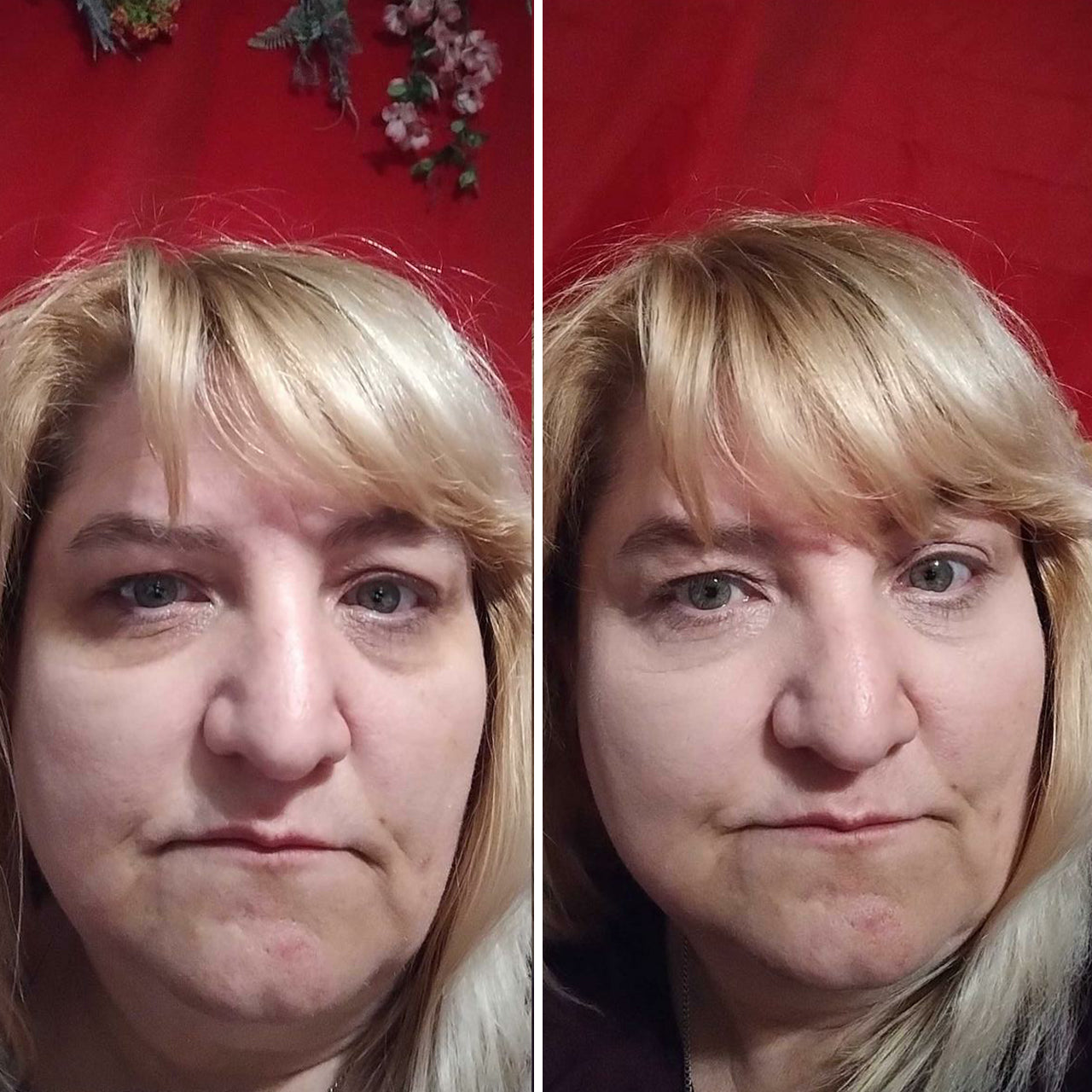 LOVILDS Under Eye Brightener with Caffeine and Peptides visibly reduces dark circles and brightens